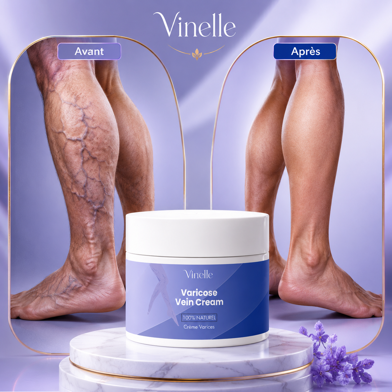 Vinelle™ | Stop aux Varices Visibles et aux Jambes Lourdes